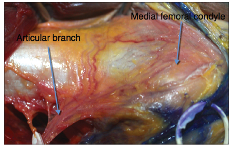 Anatomic variability of the vascularized composite osteomyocutaneous ﬂap from the medial femoral condyle: an anatomical study