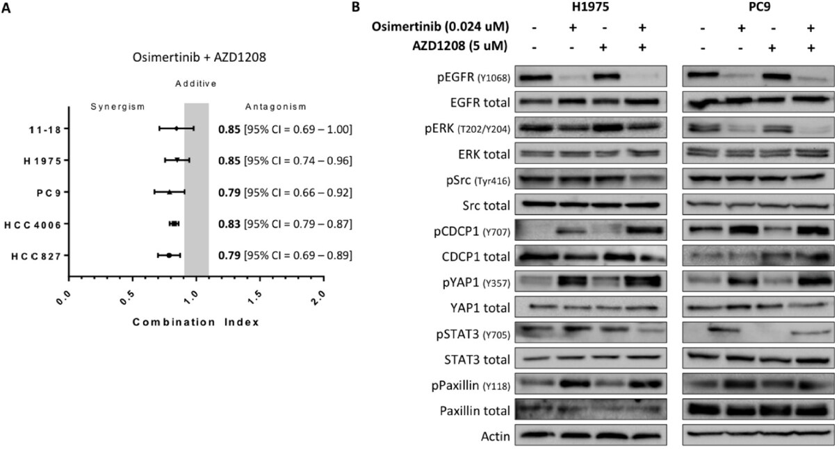 PIM-1 inhibition with AZD1208 to prevent osimertinib-induced resistance in EGFR-mutation positive non-small cell lung cancer