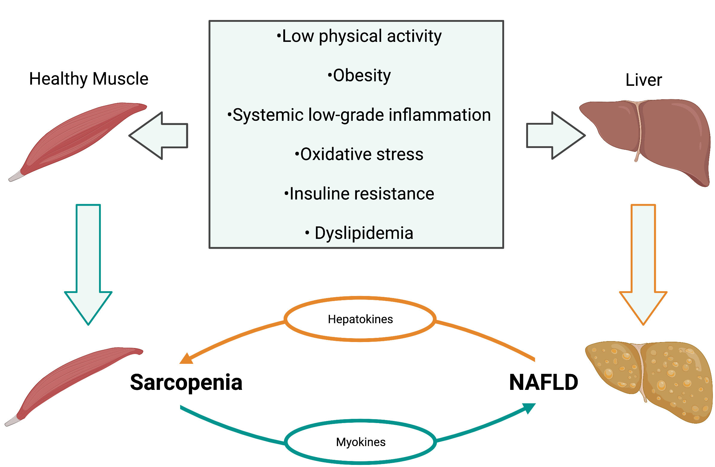 Sarcopenia in the setting of nonalcoholic fatty liver
