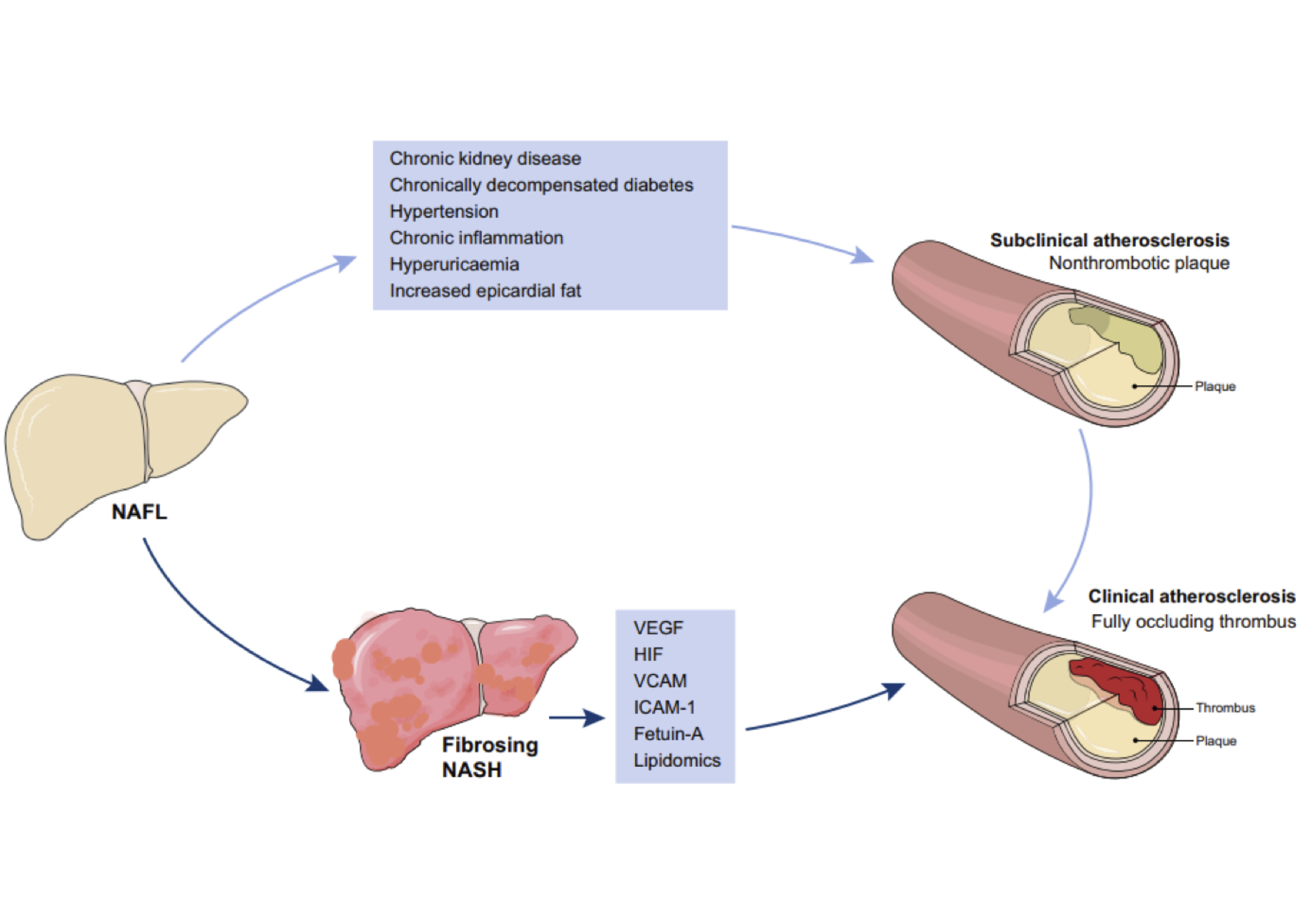 Liver fibrosis in nonalcoholic fatty liver disease patients: noninvasive evaluation and correlation with cardiovascular disease and mortality