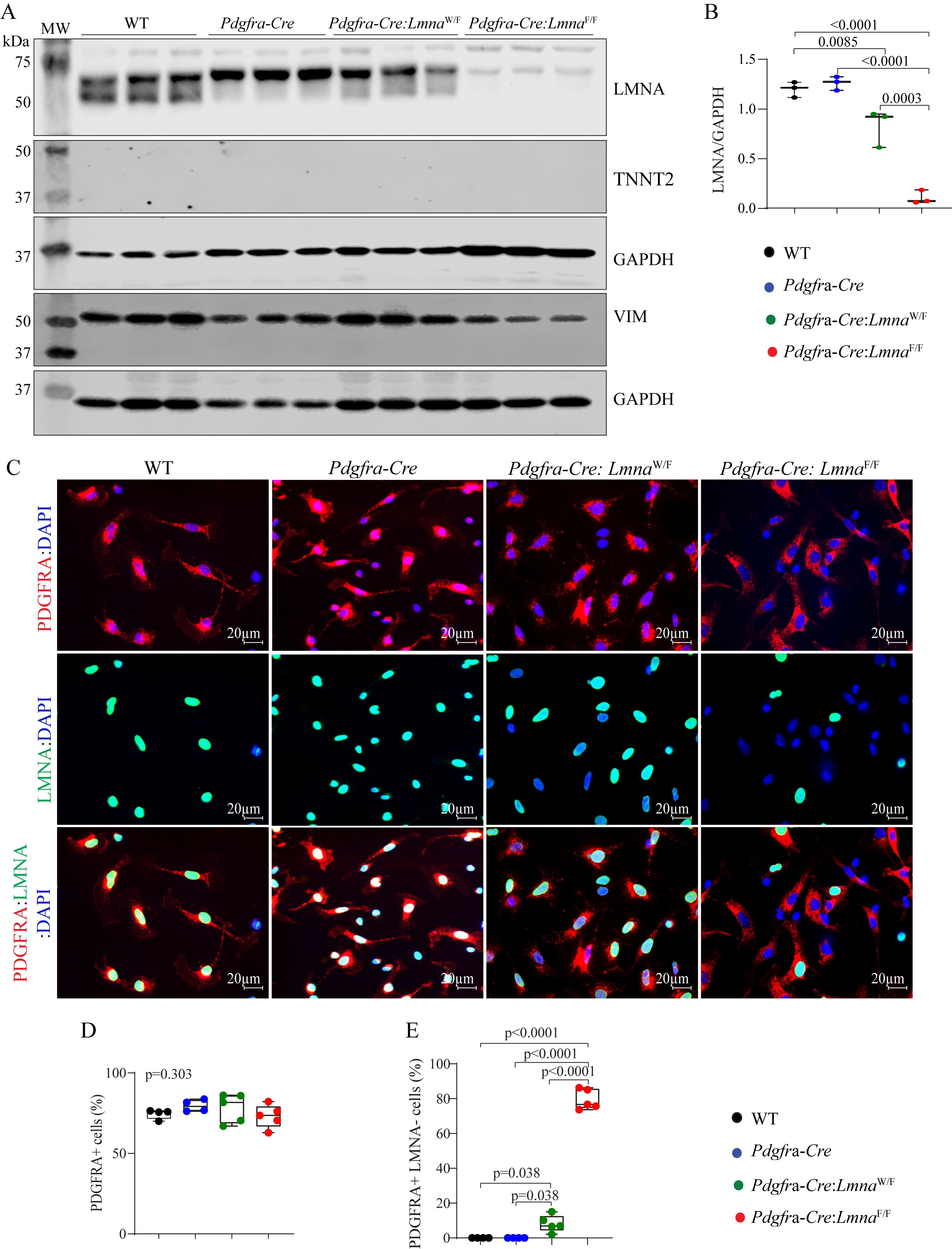 Deletion of the <i>Lmna </i>gene in fibroblasts causes senescence-associated dilated cardiomyopathy by activating the double-stranded DNA damage response and induction of senescence-associated secretory phenotype