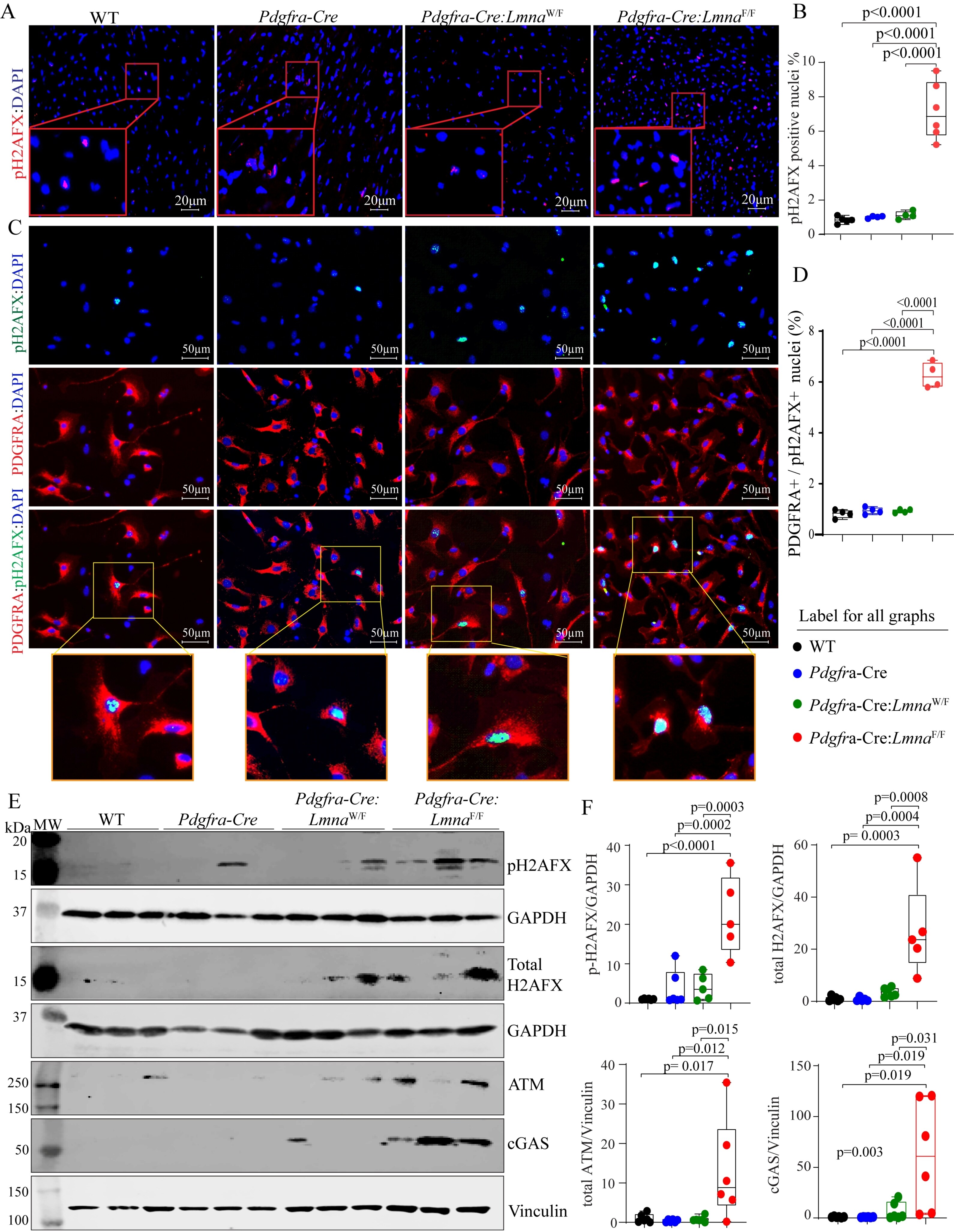 Deletion of the <i>Lmna </i>gene in fibroblasts causes senescence-associated dilated cardiomyopathy by activating the double-stranded DNA damage response and induction of senescence-associated secretory phenotype