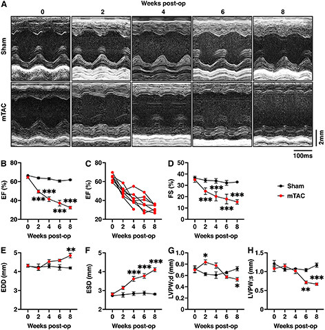 Characterization of atrial and ventricular remodeling in an improved minimally invasive mouse model of transverse aortic constriction