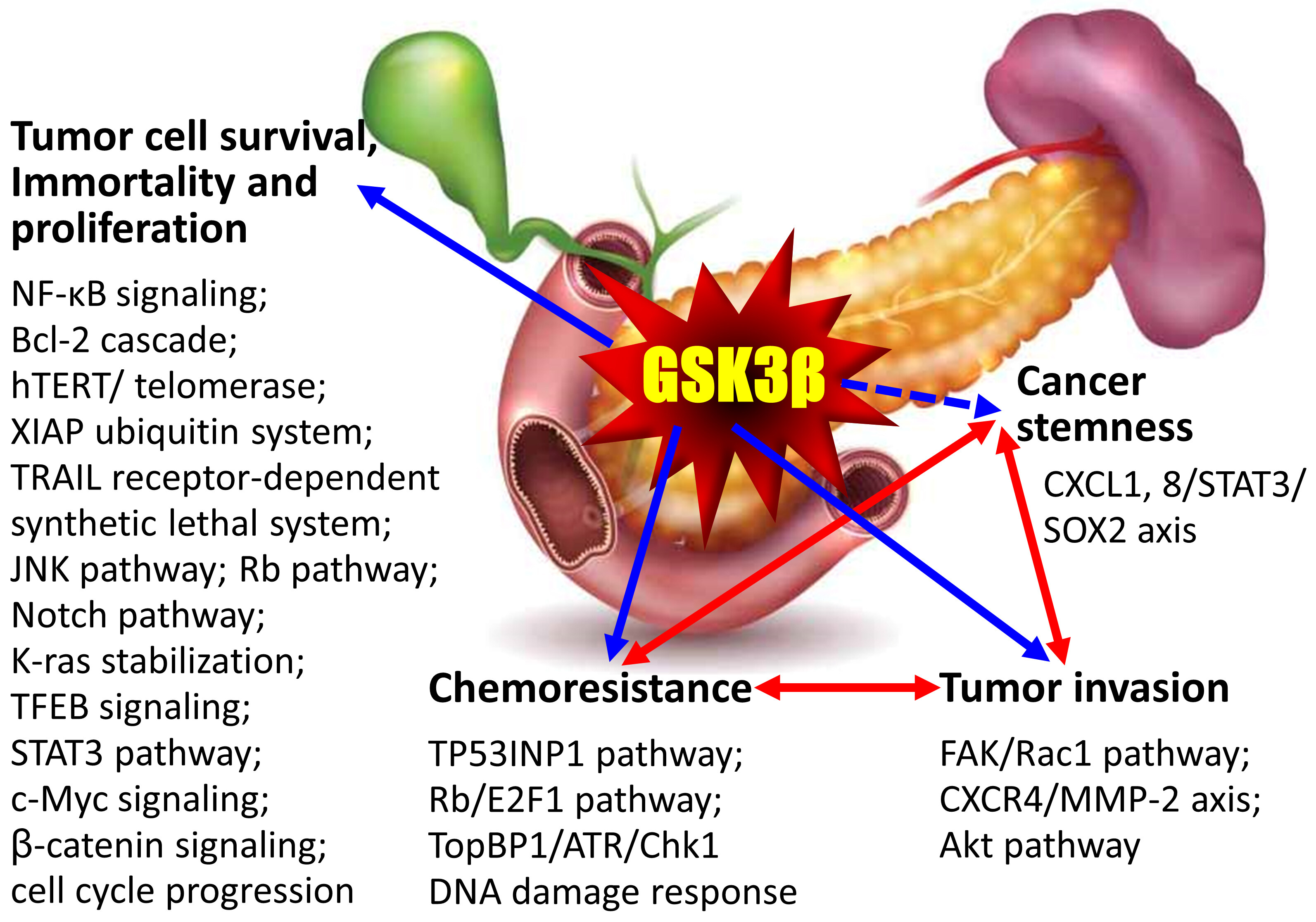Glycogen synthase kinase 3β: the nexus of chemoresistance, invasive capacity, and cancer stemness in pancreatic cancer