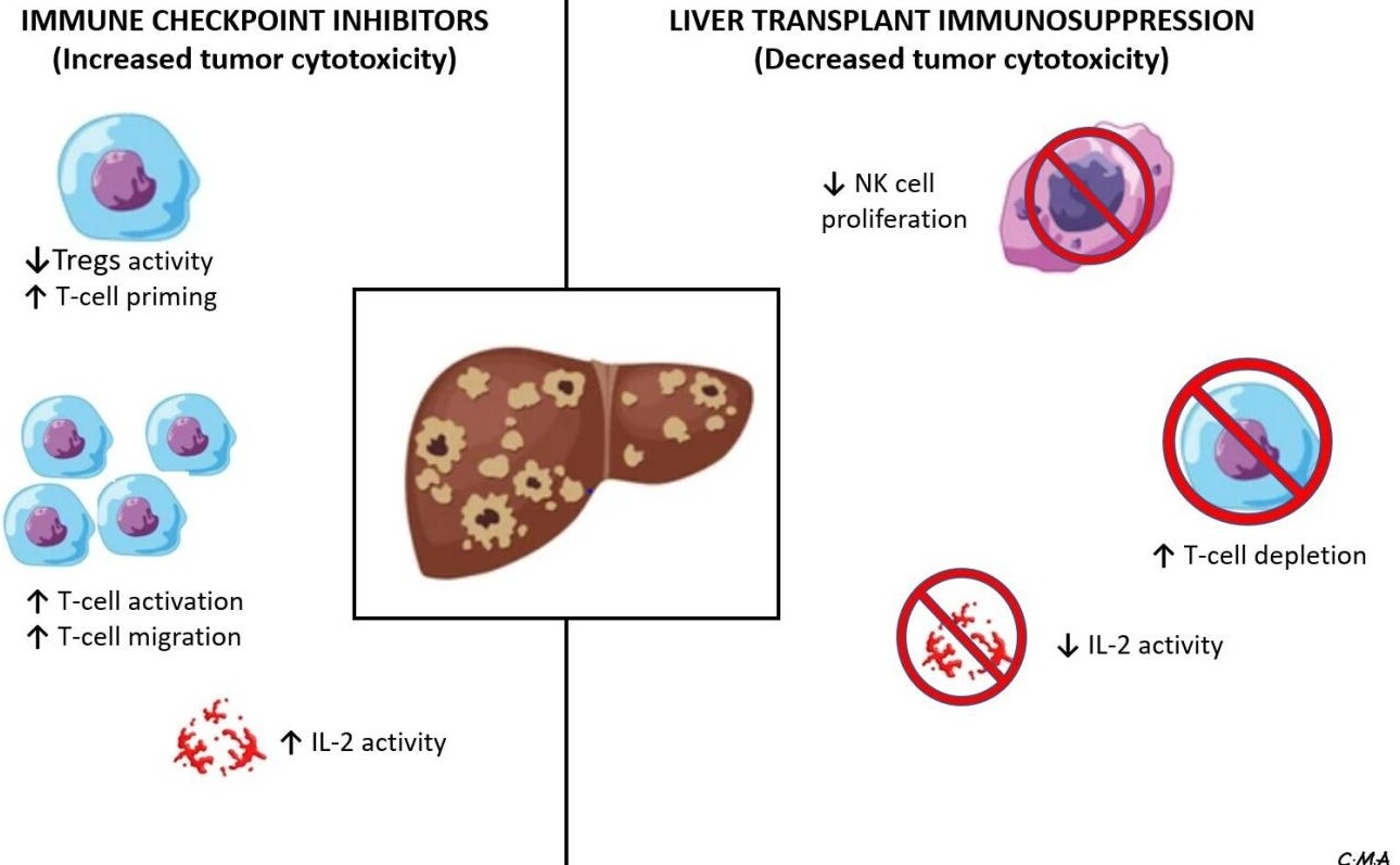 Understanding immune perspectives and options for the use of checkpoint immunotherapy in HCC post liver transplant