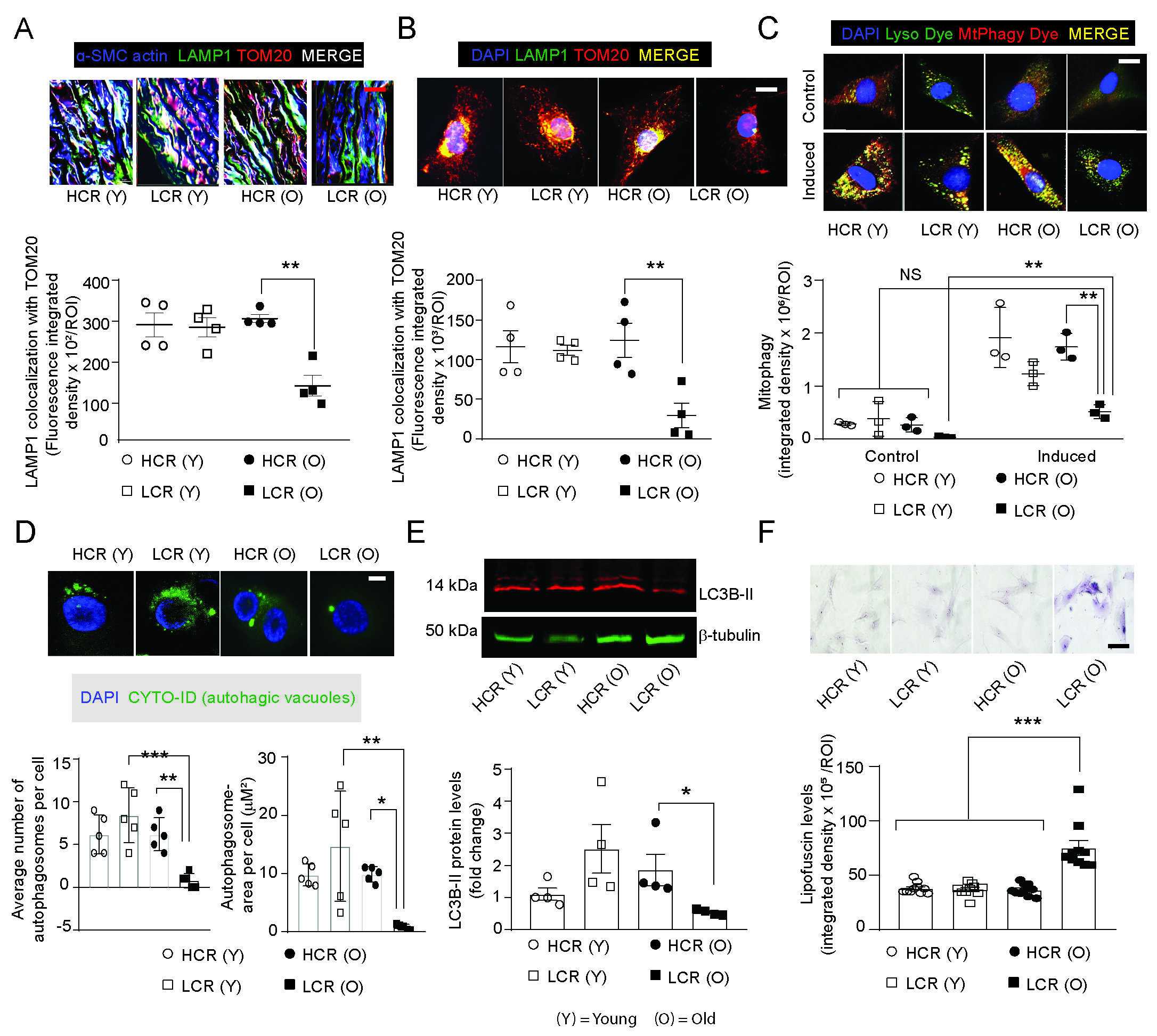 Mitochondrial DAMPs-dependent inflammasome activation during aging induces vascular smooth muscle cell dysfunction and aortic stiffness in low aerobic capacity rats