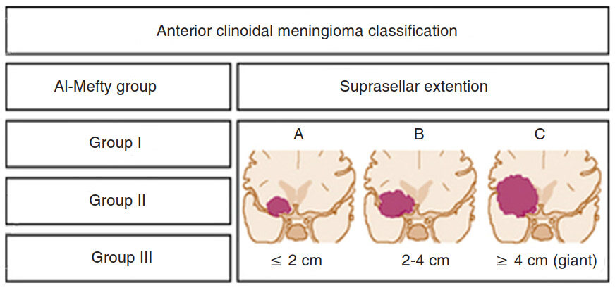 Surgical management of clinoidal meningiomas: 10 cases analysis