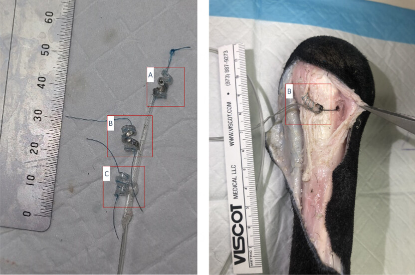Essential neural anatomy for creating a clinically translatable osseointegrated neural interface for prosthetic control in sheep