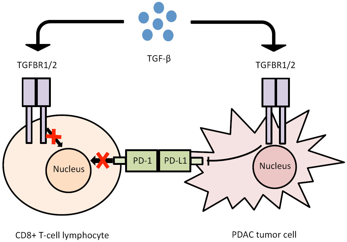 The implication of liquid biopsies to predict chemoresistance in pancreatic cancer