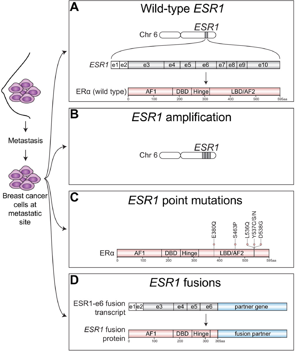 <i>ESR1</i> alterations and metastasis in estrogen receptor positive breast cancer