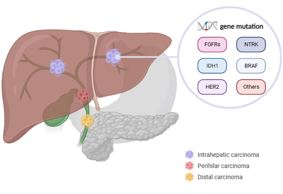 Mutation-based therapies for intrahepatic cholangiocarcinoma: new options on the horizon