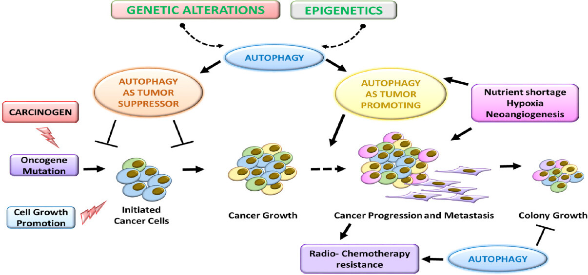 Epigenetic control of autophagy in women's tumors: role of non-coding RNAs