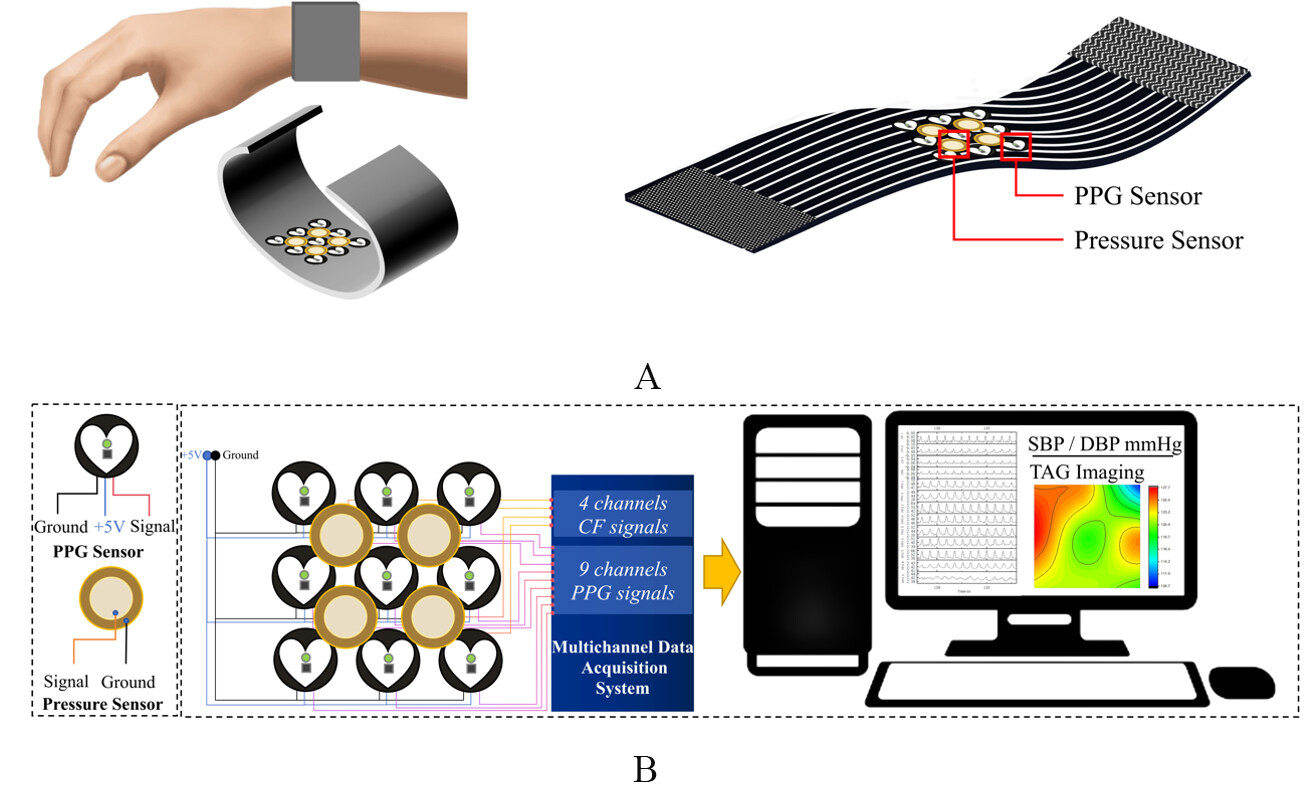 A multi-channel photoplethysmography array with contact-force regulation for tonoarteriographic imaging