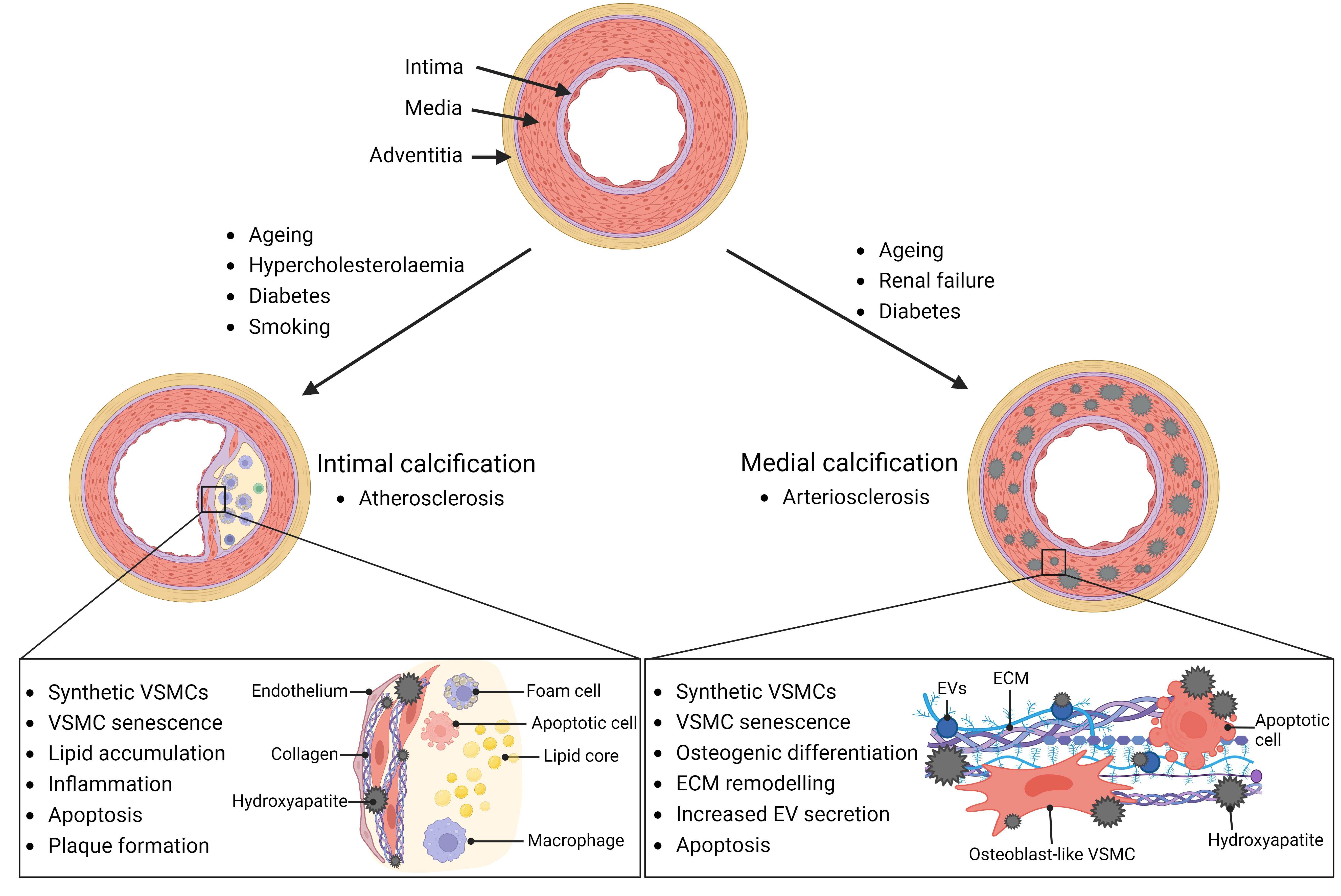 Extracellular vesicles: the key to unlocking mechanisms of age-related vascular disease?
