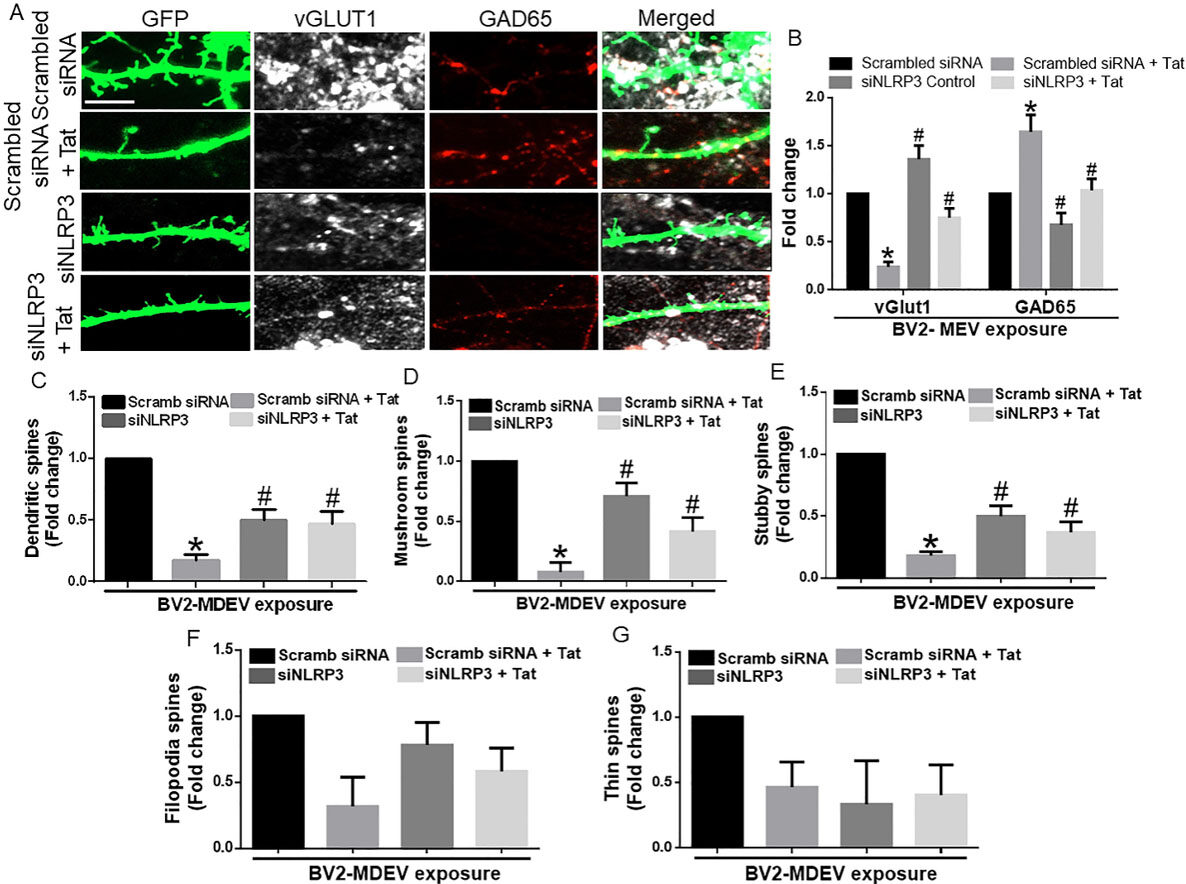 HIV-1 Tat induced microglial EVs leads to neuronal synaptodendritic injury: microglia-neuron cross-talk in NeuroHIV