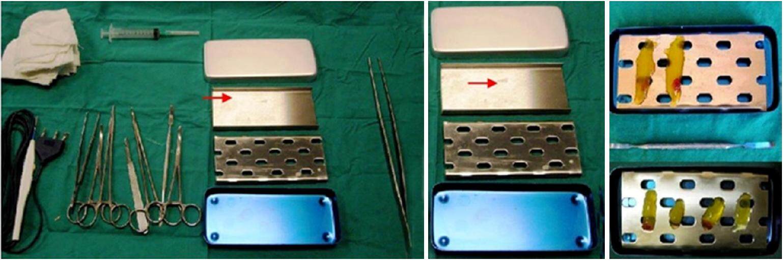 Standardized protocol proposed for clinical use of L-PRF and the use of L-PRF Wound Box®