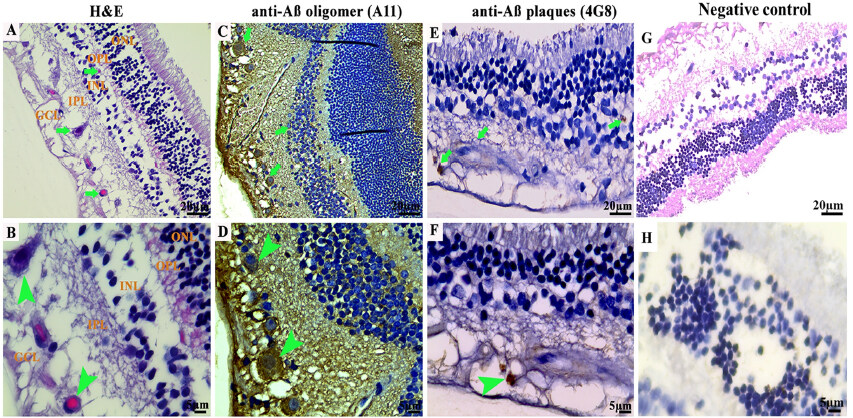 A sequential deposition of amyloid beta oligomers, plaques and phosphorylated tau occurs throughout life in the canine retina