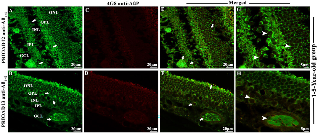 A sequential deposition of amyloid beta oligomers, plaques and phosphorylated tau occurs throughout life in the canine retina