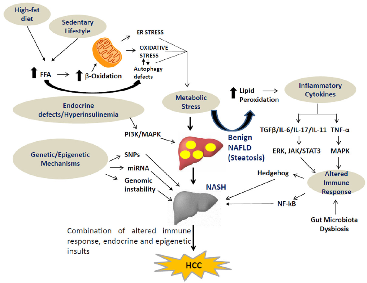 Molecular links between non-alcoholic fatty liver disease and hepatocellular carcinoma
