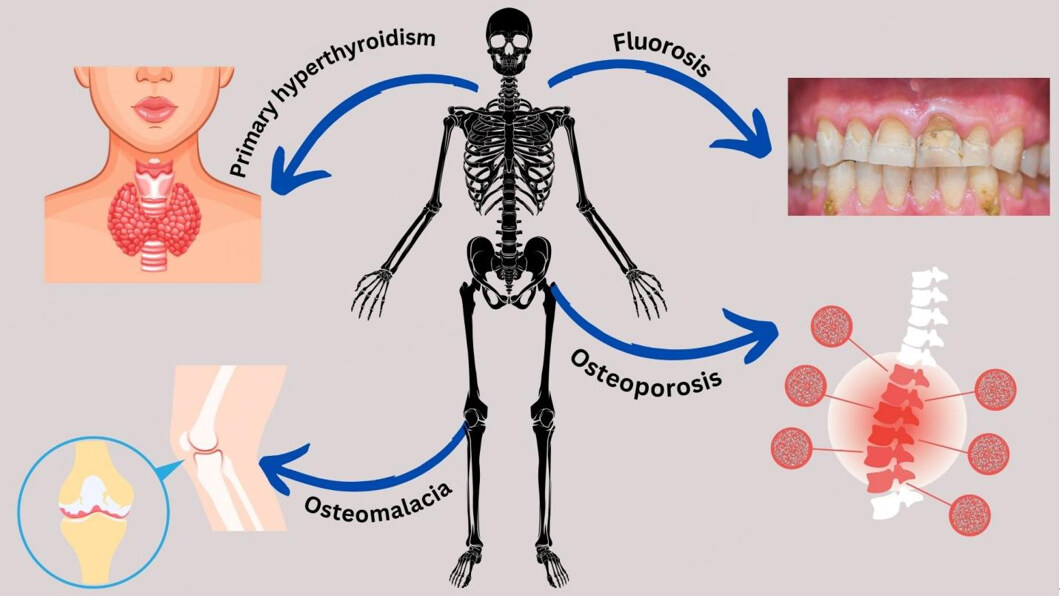Clinical frontiers of metabolic bone disorders: a comprehensive review
