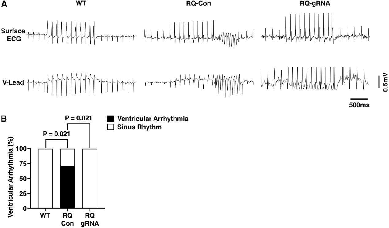 Long-term efficacy and safety of cardiac genome editing for catecholaminergic polymorphic ventricular tachycardia