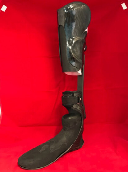 Prosthetic and orthotic options for lower extremity amputation and reconstruction